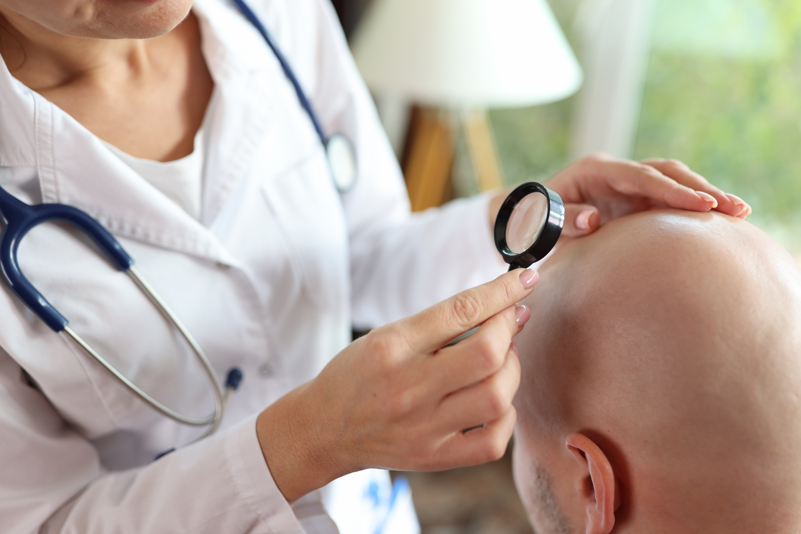 hair transplants in turkey